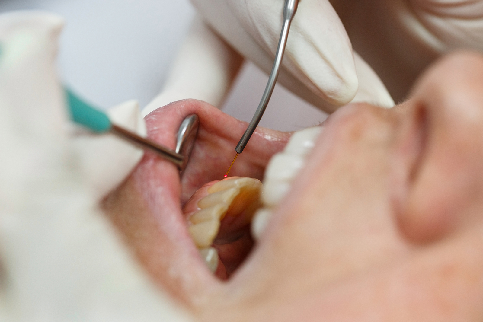 Greenfield Dental Center | Orthodontics, CBCT and Implant Restorations